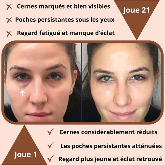 Le Masseur Oculaire Led 3D