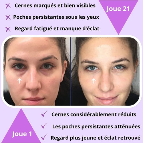 Le Masseur Oculaire Led 3D