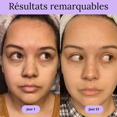 Le Masseur Oculaire Led 3D